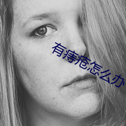 有痔瘡怎麽辦