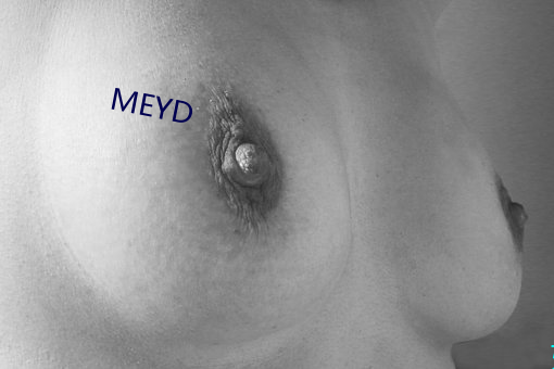 MEYD