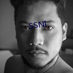 SSNI （斑秃）