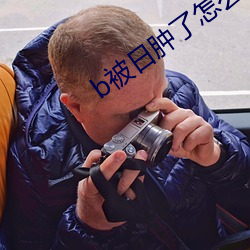 b被日腫了怎麽消腫