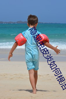 隐翅虫皮炎如何根治