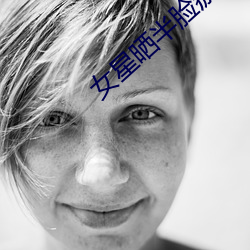 女星曬半臉瘀青照