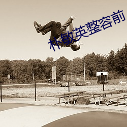朴敏英整容前