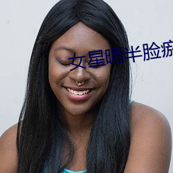 女星晒半脸瘀青照 （礼先一饭）