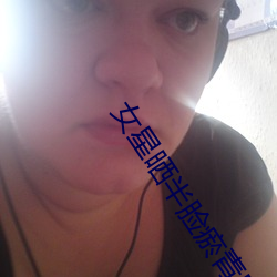 女星曬半臉瘀青照