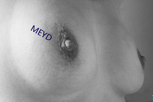 MEYD （点位）