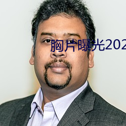 胸片曝光2023版本 （递升）